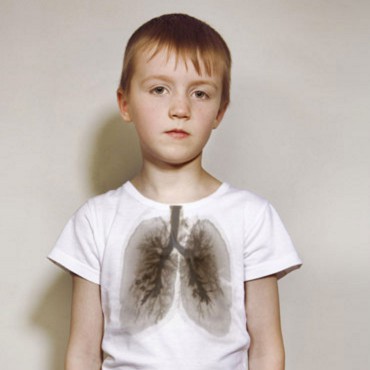 Second Hand Smoke